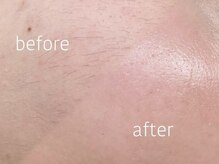 ワクシー 中目黒(WAXYYY.)/フェイスワックスで肌質改善☆
