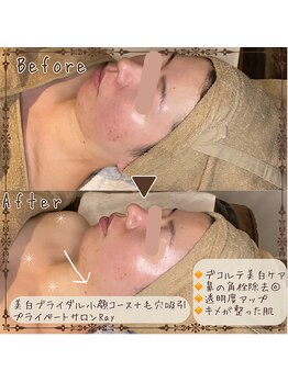 プライベートサロン レイ(Ray)/ブライダルコース