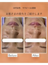 マーレ(MARE)/ララピール1回目の変化