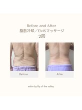 スリム(SLIM by lily of the valley)/78歳の美ボディー蘇る