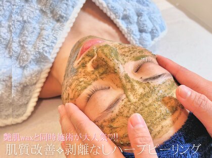 アリー(ALLY)の写真