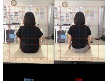 ストレチックス 近江八幡店/姿勢改善ビフォーアフター1回