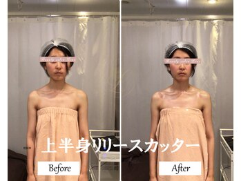 リノ(Lino)/上半身リリースカッターB&A