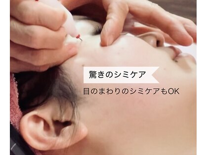 トータルエステ ユキ(YUKI)の写真