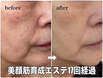 リエル(RIEL)/小顔矯正×美顔筋育成エステ