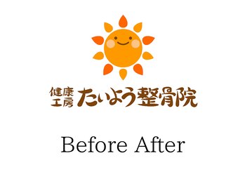 健康工房たいよう整骨院/Before After