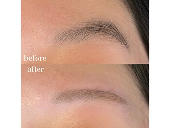 ダン(dan)/【EYEBROW WAX】症例