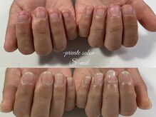 エスネイル(S-nail)