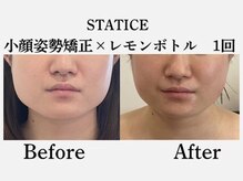 スターティス(STATICE)の雰囲気（結果重視◎ノアグロウ使用し肌の内側にダイレクトに届けます！）