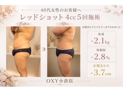 オキシー グレイス 小倉店(OXY Grace)の写真