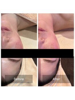 スムース(smooth)/フェイシャル：復元パック(磁気)