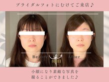 ソルビーフェイス(SOL*BeFace)/ブライダルフォトにむけて☆