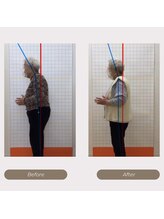 かがわ接骨院 高松伏石院/姿勢の悪さでお悩みの方！