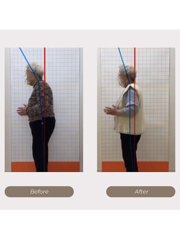 かがわ接骨院 高松伏石院/姿勢の悪さでお悩みの方！