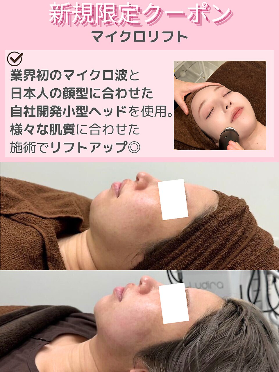 【お顔脂肪撃退☆】マイクロ波リフトで最新小顔13000円
