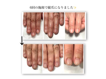 ネイルサロン ピーアンドビー(P&B)の写真
