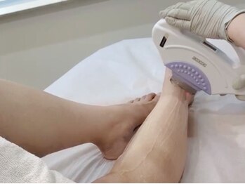 スターラッシュ(Star Lash)/産毛までしっかりとって艶肌な足