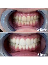 ライトビューティー 池袋店(LightBeauty)/症例写真