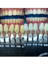 トウキョウスワーズ 池袋店(TOKYO SWRS)/#ホワイトニング #池袋 #渋谷