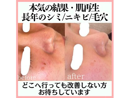 リアリア(LEALEA)の写真