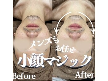 ラフィール/小顔マジック