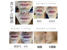 美痩身(bisoshin)