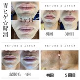 美痩身(bisoshin)