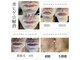 美痩身(bisoshin)の写真