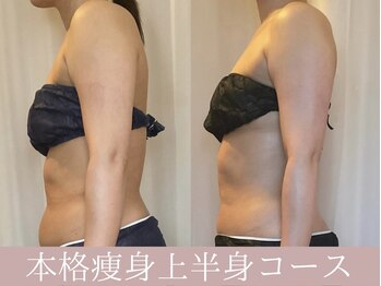 レイアス(Ray as)/姿勢も変わる◎