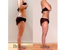 スリラ(SuriLa)の雰囲気（結果重視☆オールハンドマッサージで最短効果！）