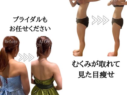 ヨサパーク メリッサ(YOSA PARK Melissa)の写真