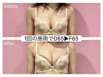 ククナ(KUKUNA)/*姿勢矯正*