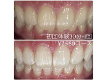 ホワイトニングルーム 横浜店(Whitening Room)/セルフホワイトニング/横浜