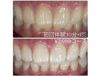 ホワイトニングルーム 横浜店(Whitening Room)/セルフホワイトニング/横浜