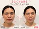 ソラナ(Solana)の写真