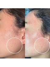 フォルマ バイ プティ(forma by puti)/フェイスwax