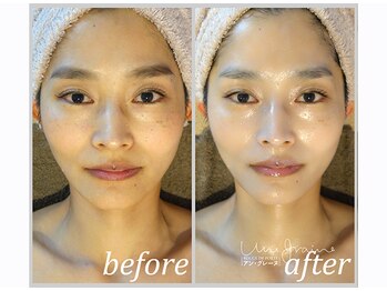 アン グレーヌ 自由が丘(unegraine)/ツヤ肌で美しさ倍増します