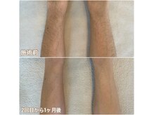 リノ沼津(Lino)の雰囲気（痛い脱毛はもう古い！効果を実感できる極上美肌脱毛★）
