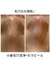 プリュボーテ(Pul Beaute)/毛穴の黒ずみの原因は？！