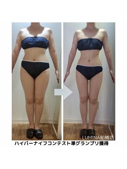 ルミナ ビューティーアンドリラックス(LUMINA Beauty&Relax)の写真/【口コミ高評価★】全国ハイパーナイフ写真コンテストで表彰された実力派【全身徹底スリム】120分が人気No1
