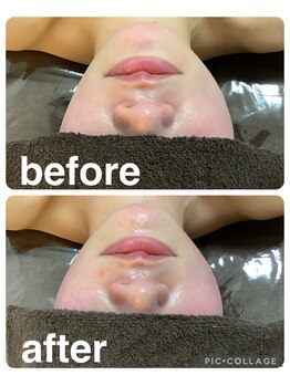 ギンザアール(GINZA R.)/小顔フェイシャル◎