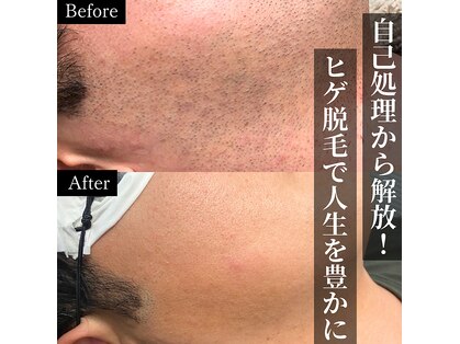 ラフ(LaFF)の写真