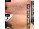 ラフ(LaFF)の写真