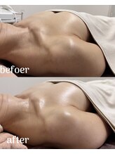 シャルマン(Charmant)/befoer.after