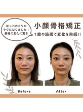 たなごころ整骨治療院 整体院/小顔矯正