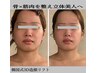 小顔人気No.1】韓国3D造顔リフト×深層筋美骨ケア　フェイスのみ