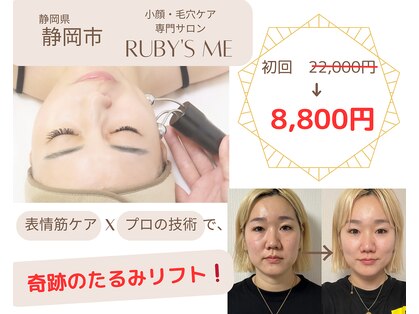 ルビーミー(Ruby's Me)の写真