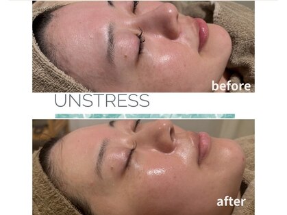 スイ(SUI)の写真