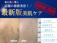 サンティエ(Santie)