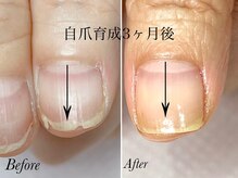 トゥインクリーネイルサロン(Twinkly Nail Salon)/【地爪育成】1回お試し